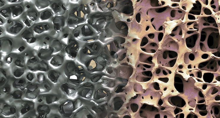 Magnified image of bone growth