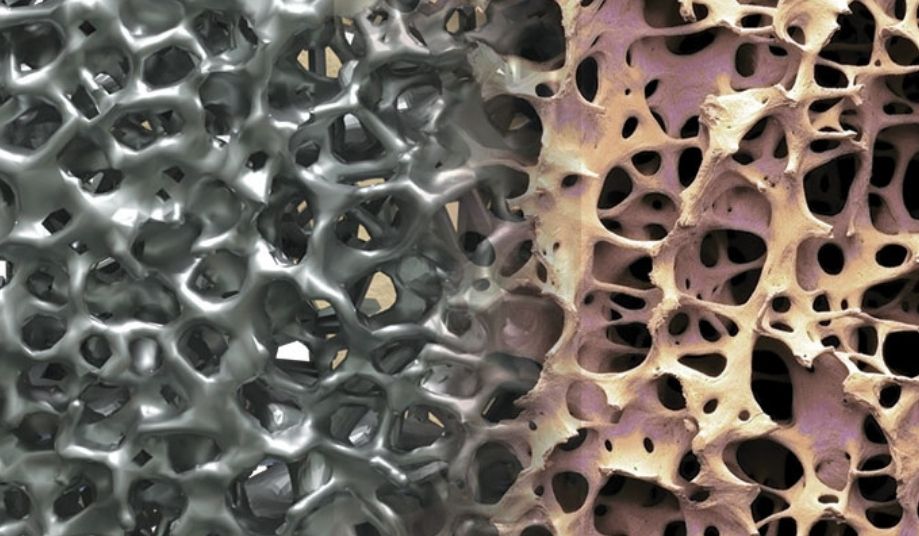 Close up of bone growth